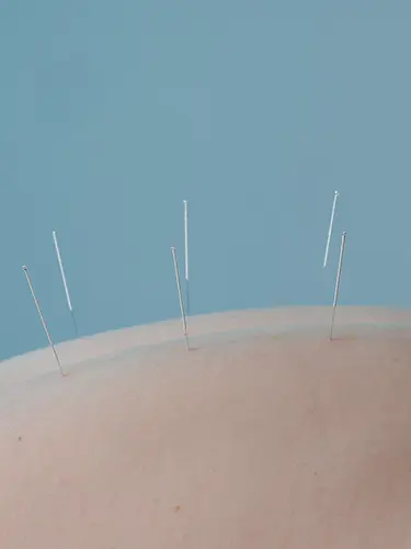 Osteopatas en Pozuelo